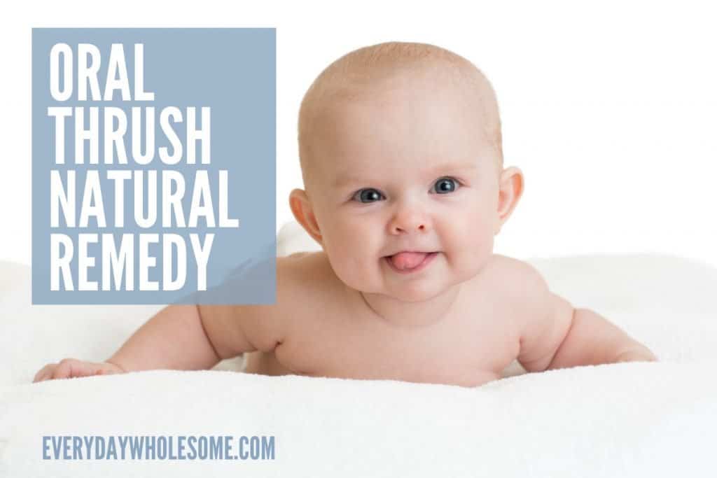 oral thrush natural remedy featured