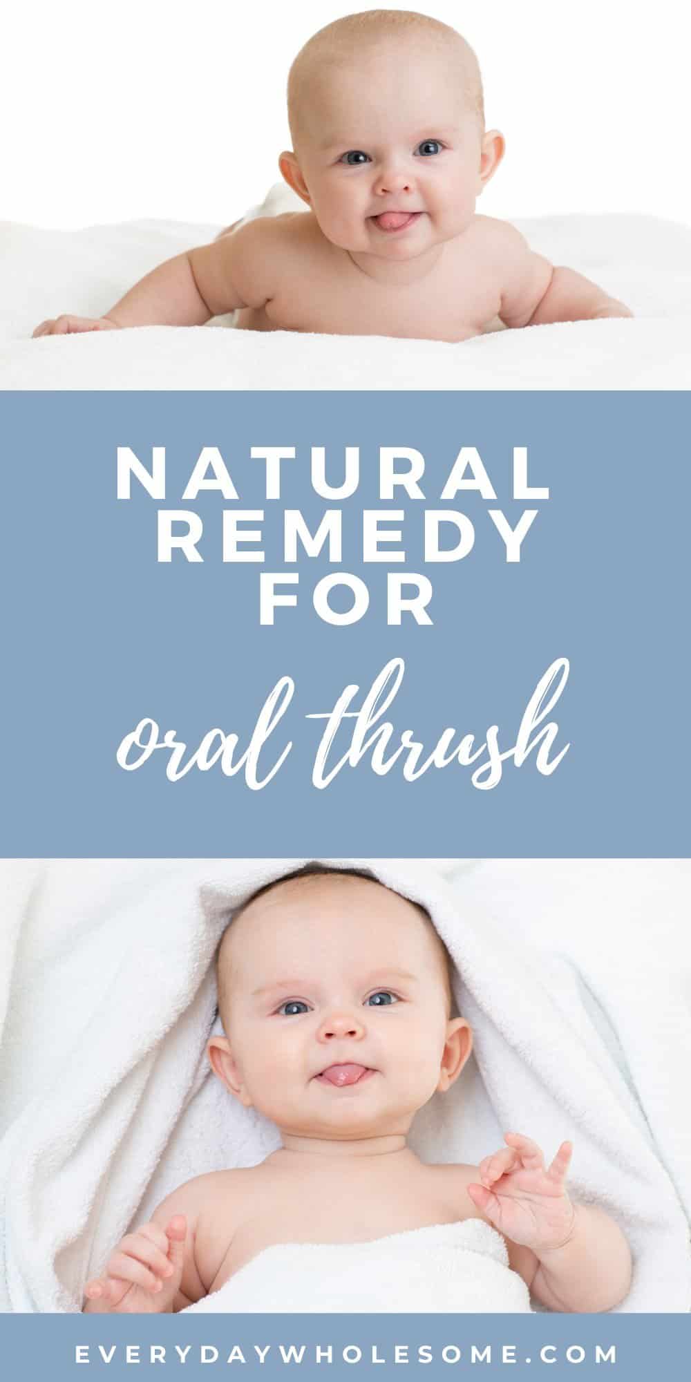 oral thrush yeast natural remedy